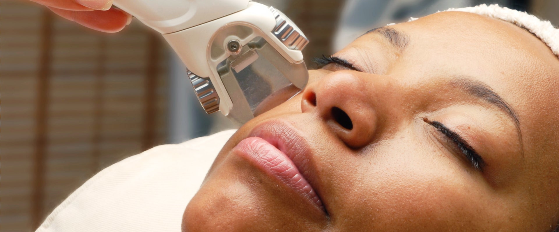 Laser Hair Removal for Dark Skin: Everything You Need to Know