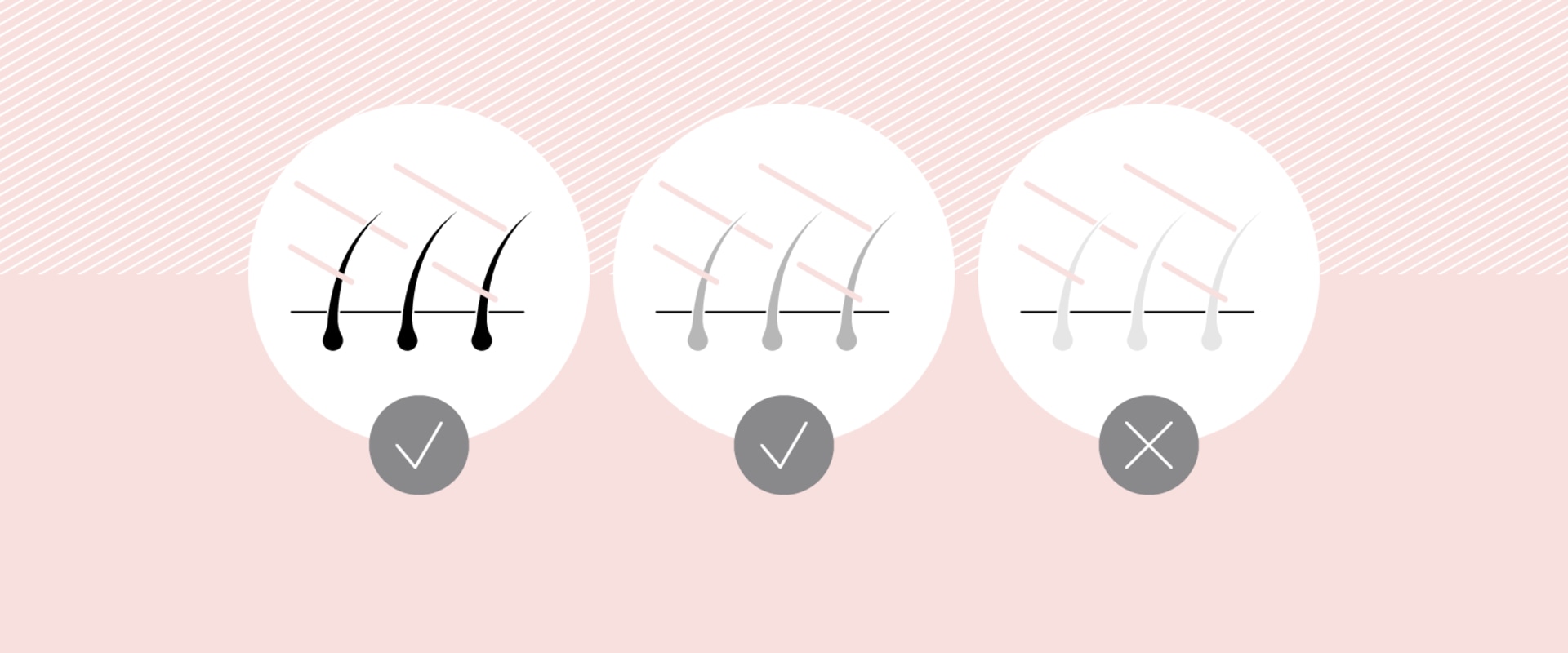 Can Laser Hair Removal Work on Blonde Hair?