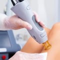 Which Laser Hair Removal is the Least Painful?