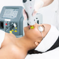 Which Laser Hair Removal Technology is Best?