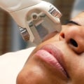 Laser Hair Removal for Dark Skin: Everything You Need to Know