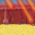 Everything You Need to Know About Laser Hair Removal