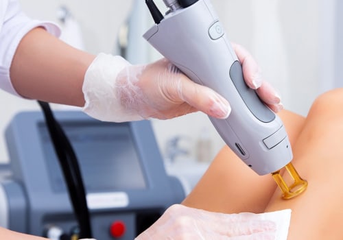 Painless Laser Hair Removal: How to Get Smooth Skin Without the Discomfort