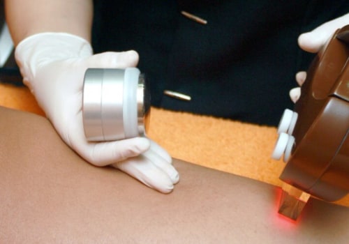 What Happens After 3 Laser Hair Removal Treatments?