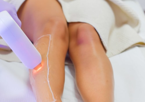 Why Laser Hair Removal Doesn't Always Work