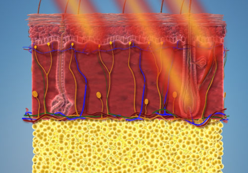 Everything You Need to Know About Laser Hair Removal
