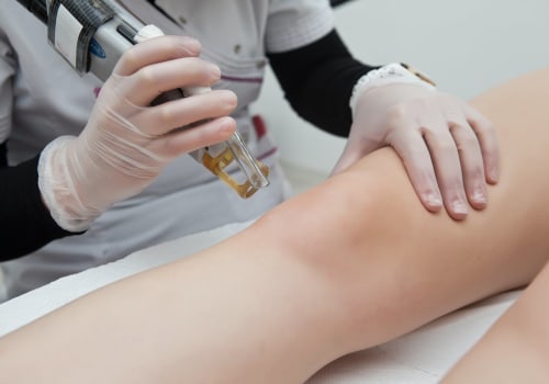 What to Avoid After Laser Hair Removal