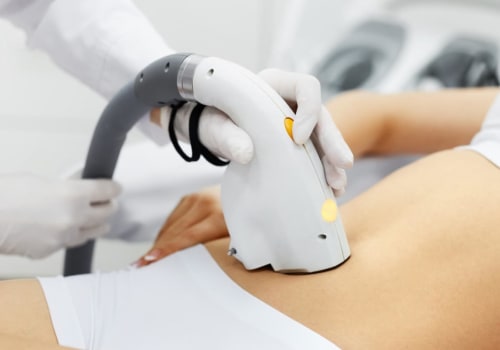 Why Laser Hair Removal Hurts and What to Expect