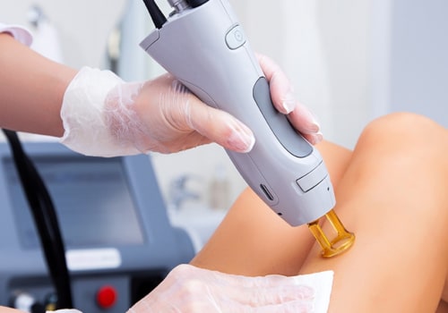 Say Goodbye to Unwanted Hair with Laser Hair Removal